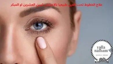 علاج الخطوط تحت العين طبيعيا بالاعشاب لسن العشرين او المبكر