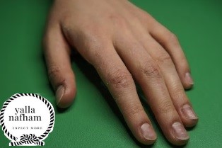 طرق ازالة الجلد الميت من اليدين