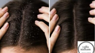 وصفات قشرة الشعر
