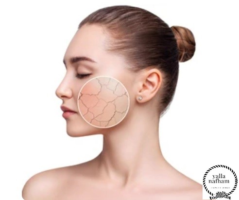 علاج طبيعي لجفاف بشرة الوجه