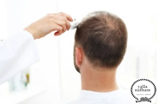 عيادات لعلاج الشعر