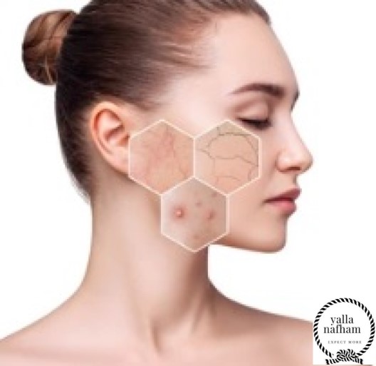 علاج خشونة بشرة الوجه